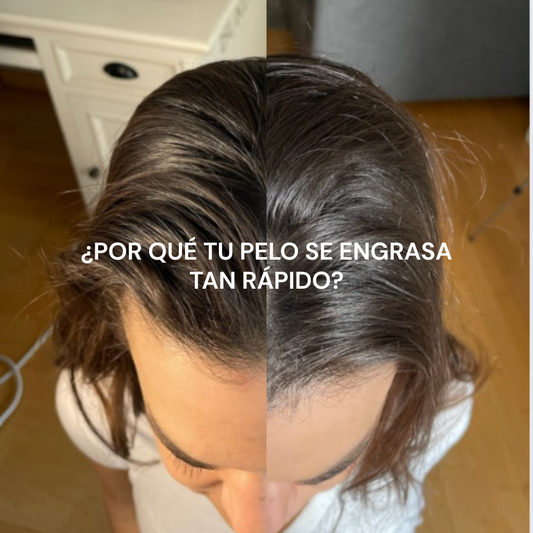 ¿Por qué tu pelo se engrasa tan rápido? Descubre las causas y cómo solucionarlo