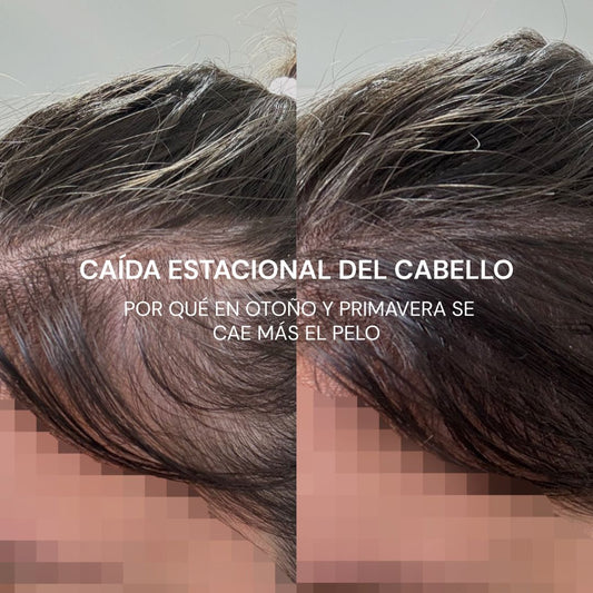 Caída del cabello