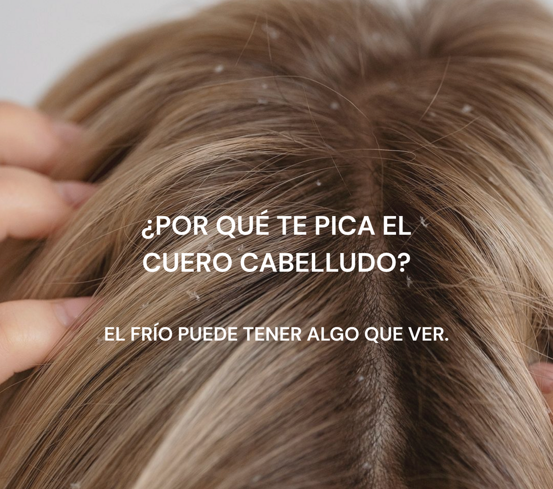 ¿Te pica más el cuero cabelludo cuando llega el frío?