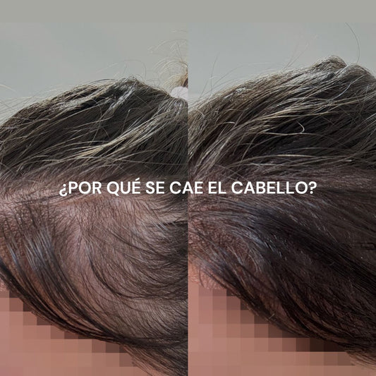 Por qué se cae el cabello — y cómo recuperarlo de verdad