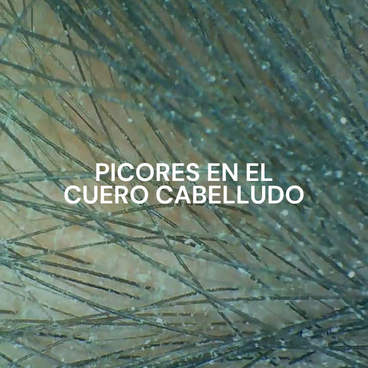 Picor en el cuero cabelludo: causas, errores comunes y cómo aliviarlo de forma natural