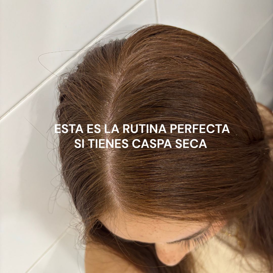 Caspa seca y piel sensible: la rutina que tu cuero cabelludo merece