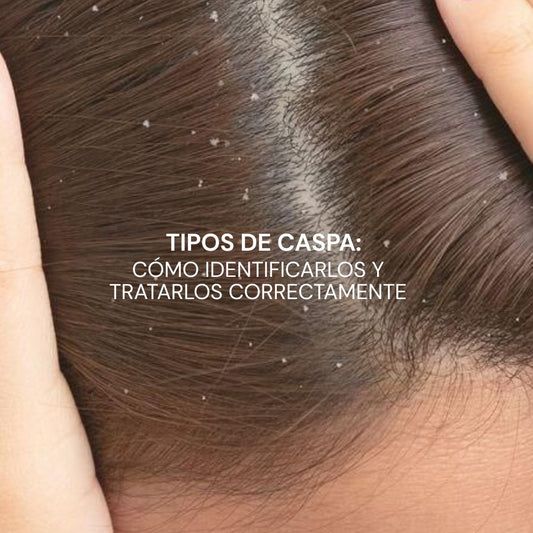Tipos de caspa: cómo identificarlos y tratarlos correctamente