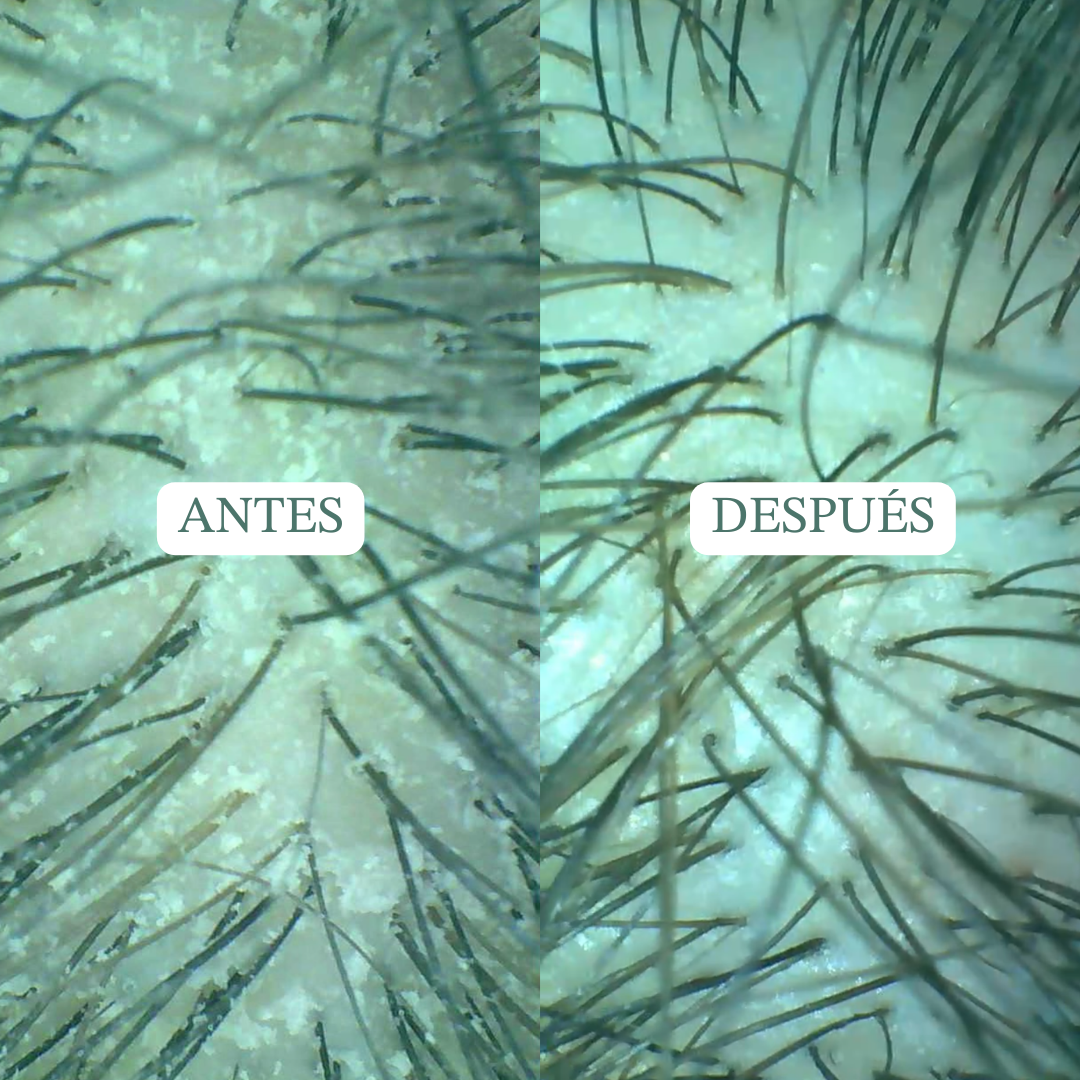 Champú detox exfoliante