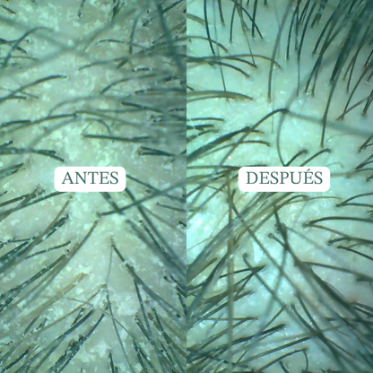 Champú detox exfoliante