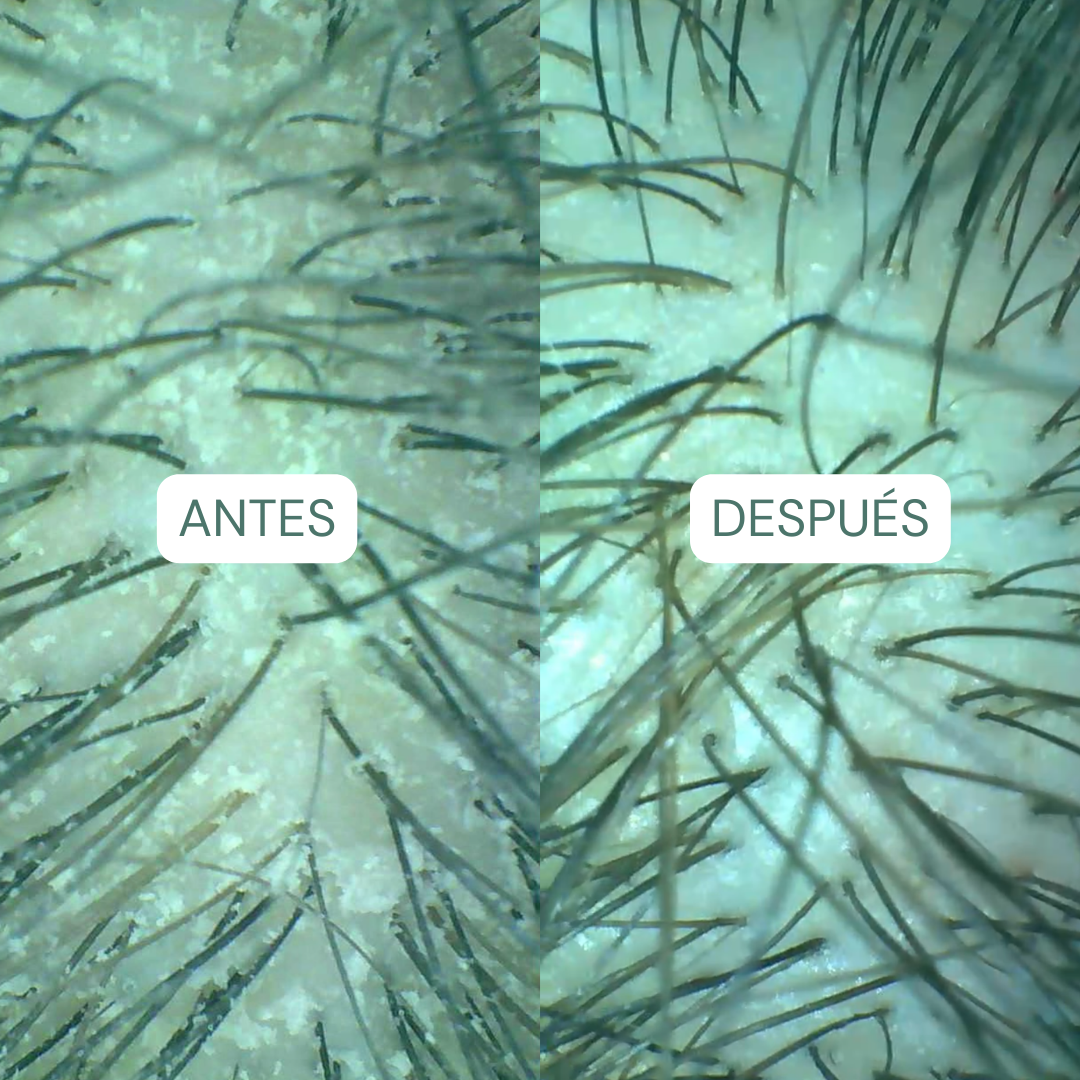 Rutina detox completa para raíces grasas