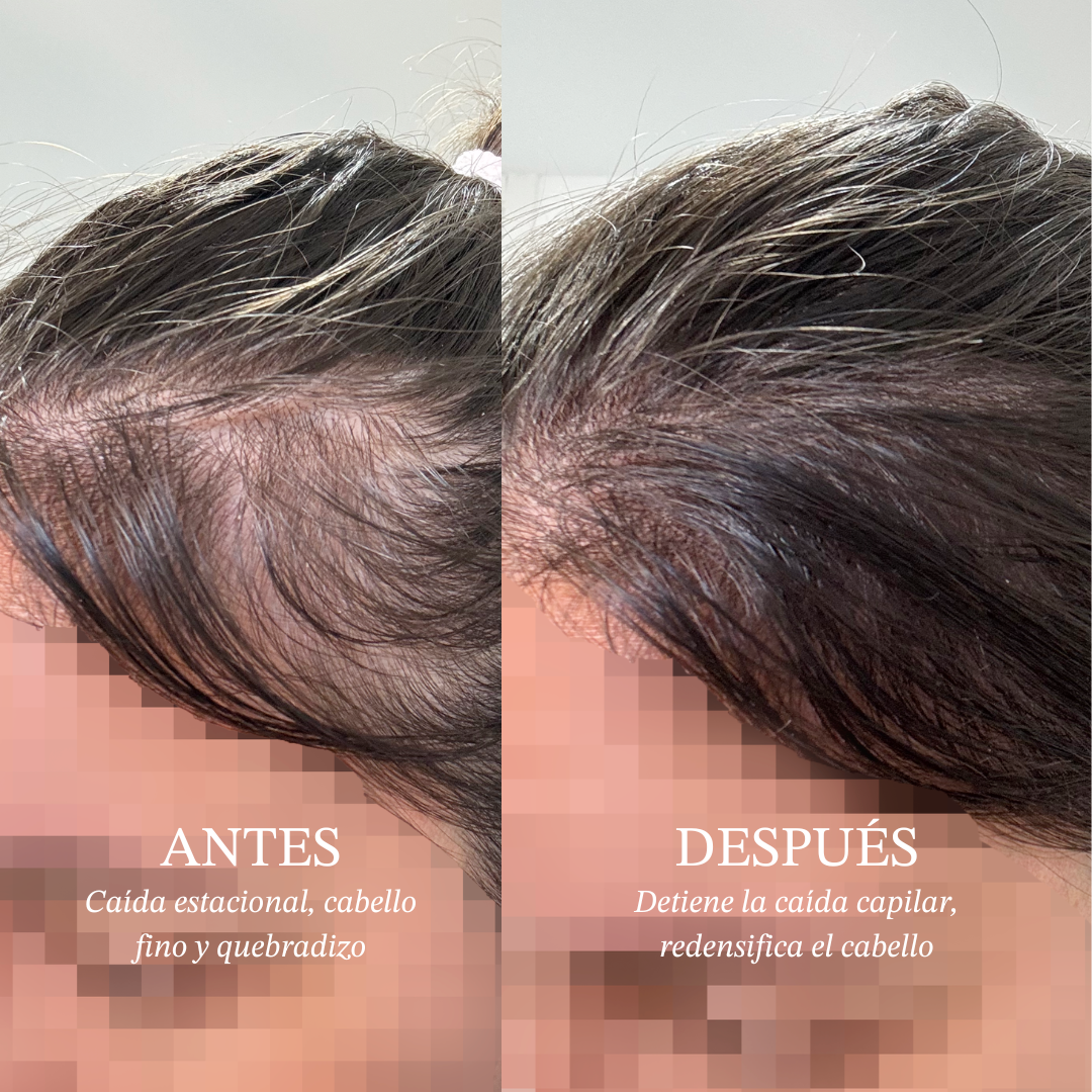 Quebradizo Cabello Seco Causas Causas Del Cabello Seco Y